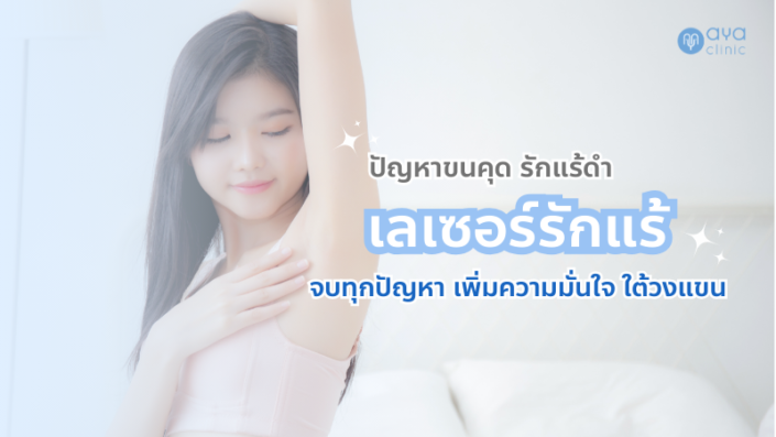 เลเซอร์กำจัดขนรักแร้