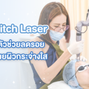 ตัวช่วยลดรอยสิว รอยดำ