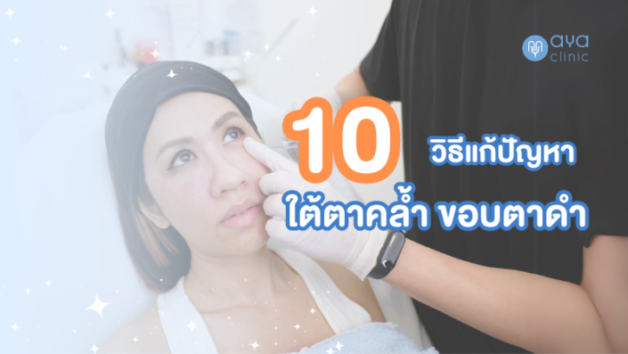 10 วิธีแก้ไขใต้ตาคล้ำ