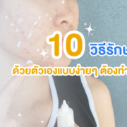 10 วิธีรักษาสิว