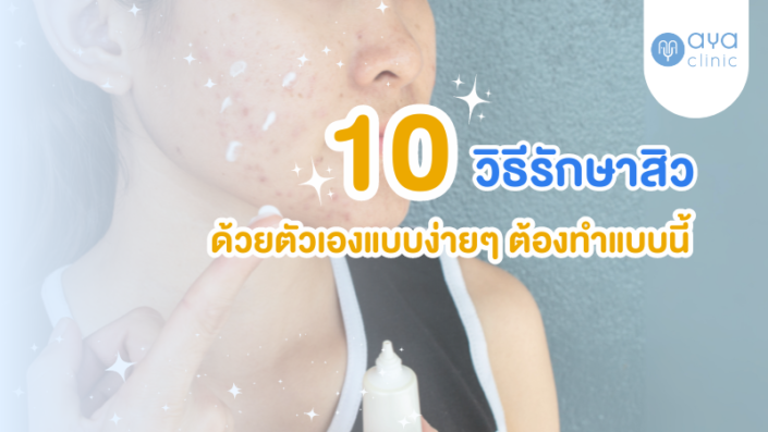 10 วิธีรักษาสิว