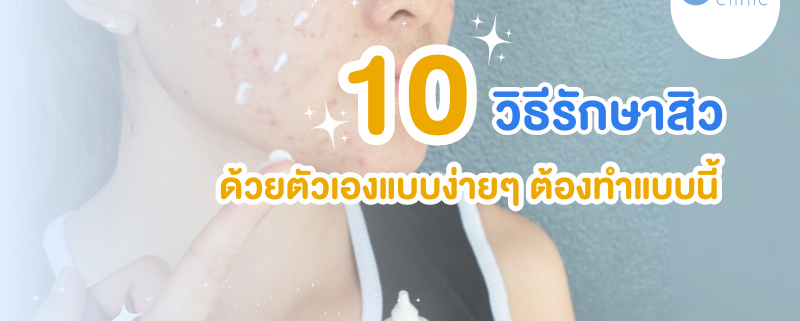 10 วิธีรักษาสิว
