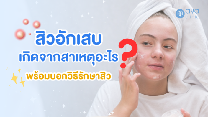 สิวอักเสบเกิดจากอะไร รักษาอย่างไร