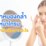 ปัญหาหน้าหมองคล้ำ