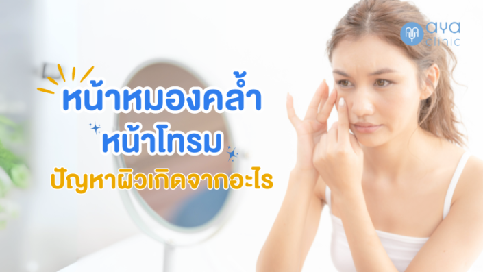 ปัญหาหน้าหมองคล้ำ