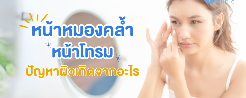 ปัญหาหน้าหมองคล้ำ