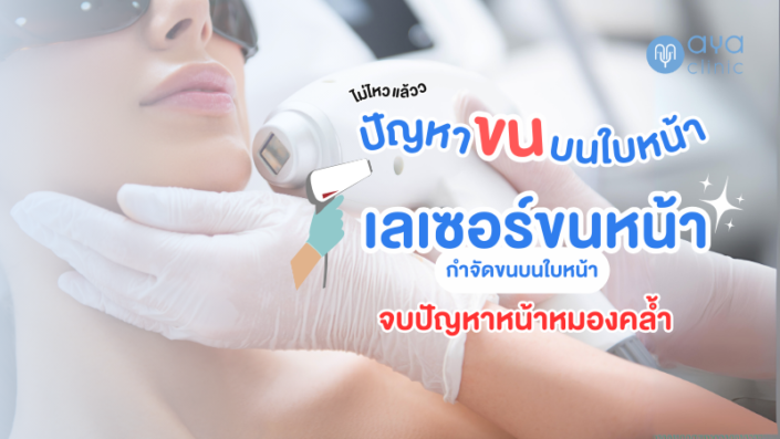 กำจัดขนบนใบหน้าด้วย Diode Laser กำจัดขนบนใบหน้าด้วย Diode Laser