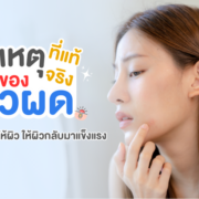 สาเหตุการเกิดสิวผด