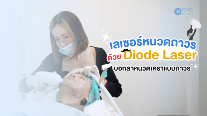 เลเซอร์กำจัดหนวด เลเซอร์กำจัดหนวด