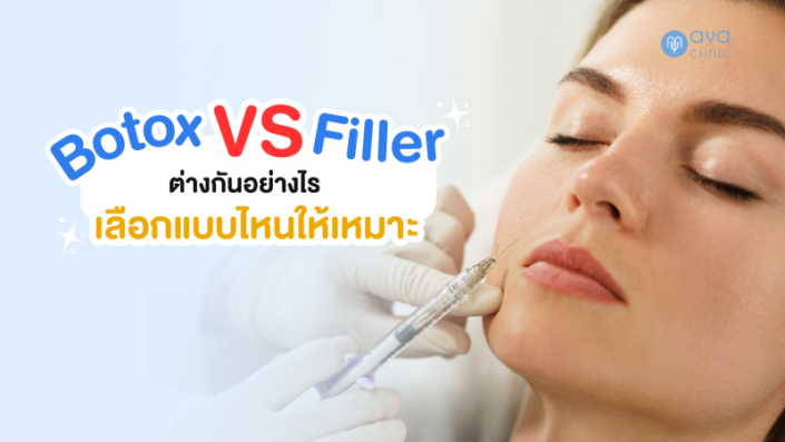 Botox Filler ต่างกันอย่างไร Botox Filler ต่างกันอย่างไร