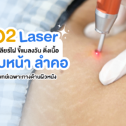 กำจัดไฝ ขี้แมลงวันด้วย CO2 laser