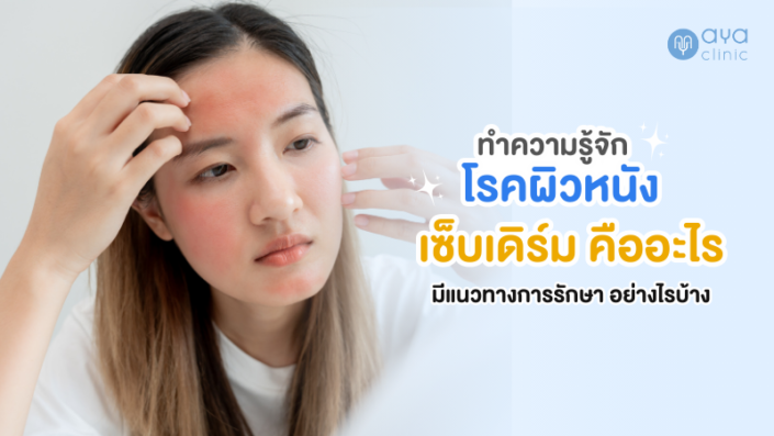 เซ็บเดิร์มรักษาอย่างไร เซ็บเดิร์มรักษาอย่างไร