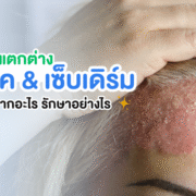 เซ็บเดิร์มรังแค