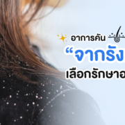อาการคันจากรังแค