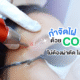 กำจัดไฝด้วยCo2