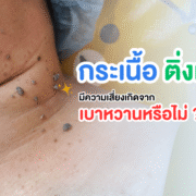 กระเนื้อ ติ่งเนื้อ เสี่ยงเบาหวาน