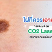 ไฝที่กลายเป็นโรคอื่น