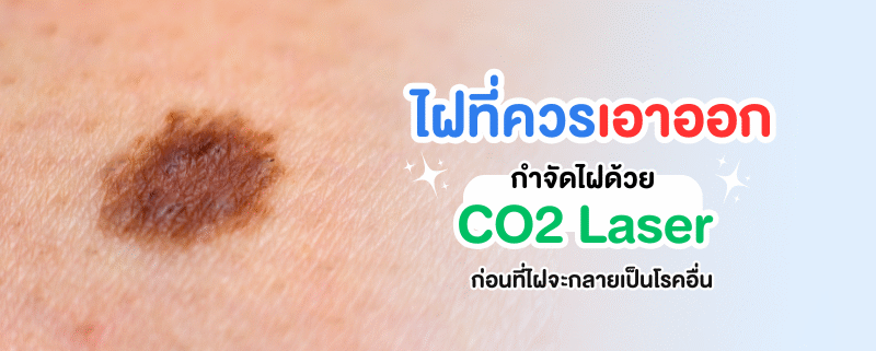 ไฝที่กลายเป็นโรคอื่น