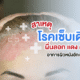 สาเหตุของโรคเซ็บเดิร์ม