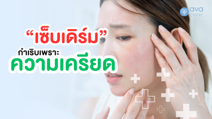 เซ็บเดิร์มกับความเครียด เซ็บเดิร์มกับความเครียด