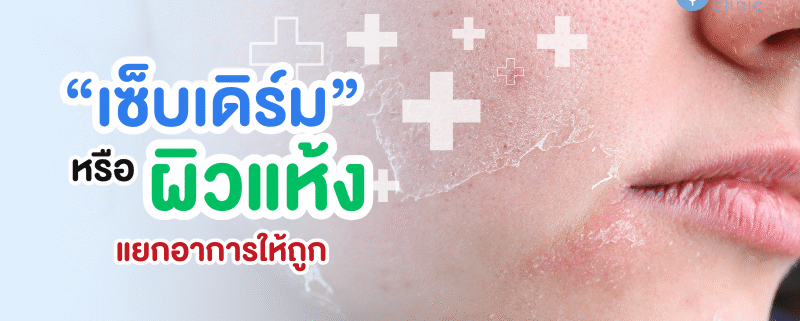 เซ็บเดิร์มกับผิวแห้ง