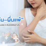 รักษาผื่นคัน ผื่นแพ้