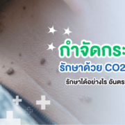 การกำจัดกระเนื้อ