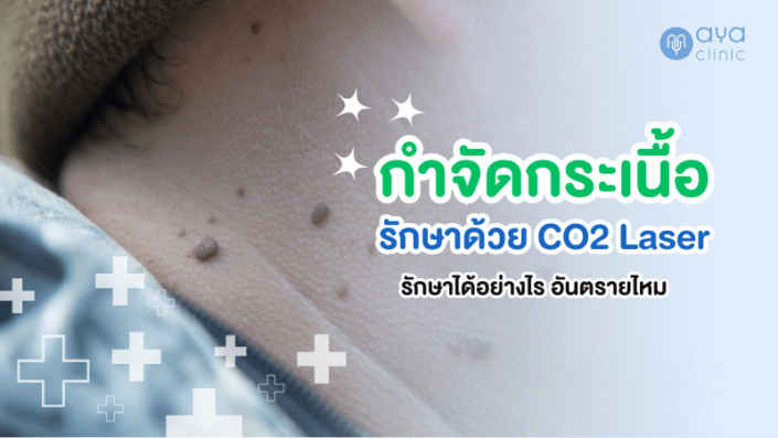 การกำจัดกระเนื้อ การกำจัดกระเนื้อ