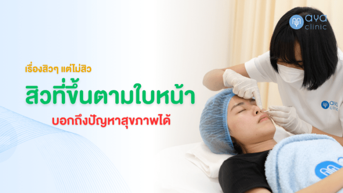 ตำแหน่งสิวบ่งบอกถึงอะไรได้บ้าง