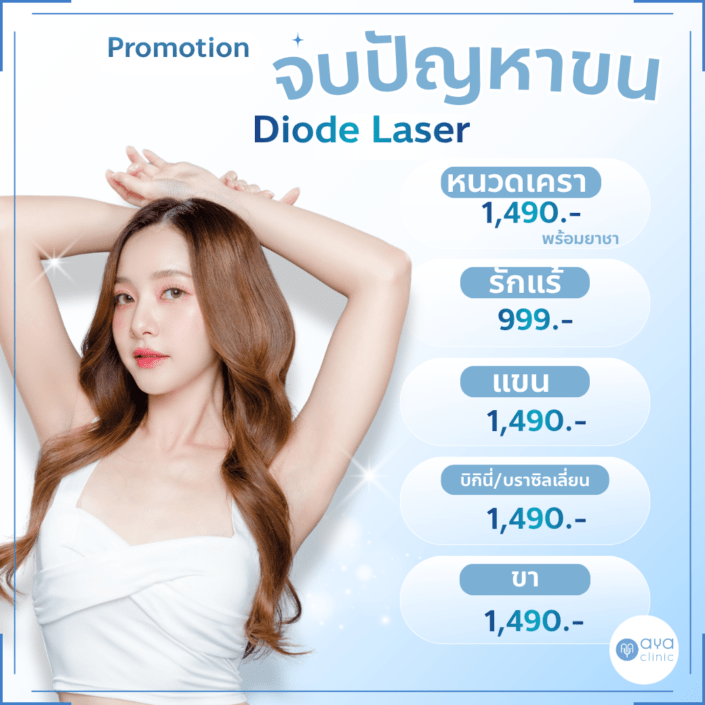 Diode Laser กำจัดขนทุกส่วน