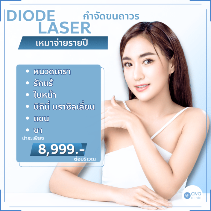 Diode Laser กำจัดขนรายปี