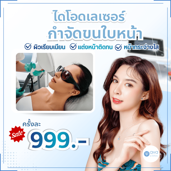 Diode Laser กำจัดขนใบหน้า