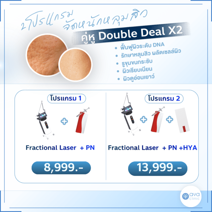 รักษาหลุมสิว เติมน้ำให้ผิว