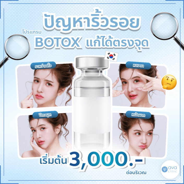 ลดริ้วรอยด้วย BOTOX