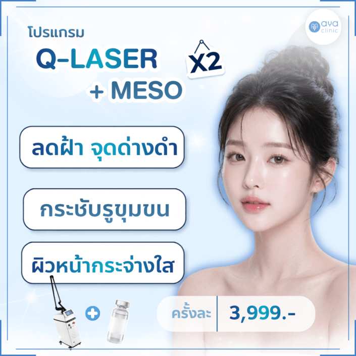 เลเซอร์ลดจุดด่างดำ