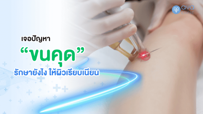 แก้ปัญหาขนคุด
