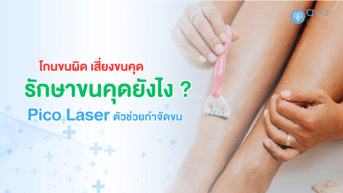 PICO รักษาขนคุด